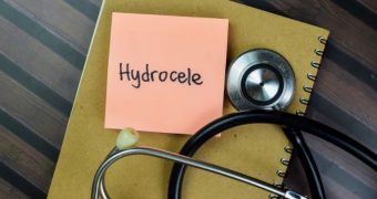 Hidrocel. Factori de risc și tratament