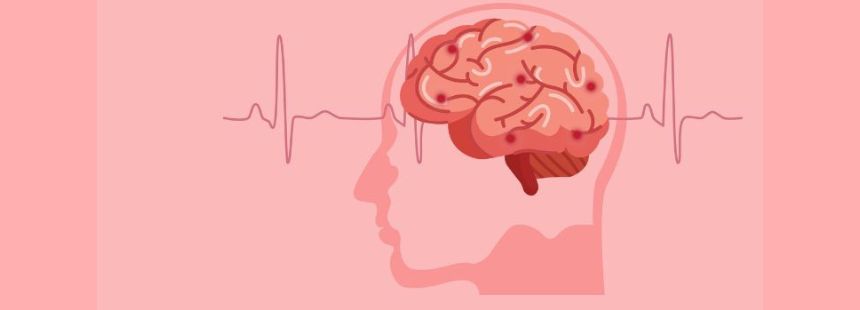 Accidentul vascular cerebral. Tot ce trebuie să știţi