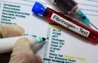 Afecțiunile asociate unui fibrinogen crescut