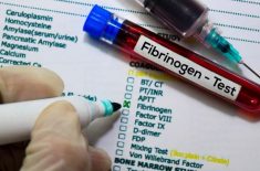 Afecțiunile asociate unui fibrinogen crescut
