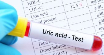 Nivel crescut de acid uric: întrebări și răspunsuri
