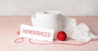Hemoroizi externi – cauze, diagnostic și tratament