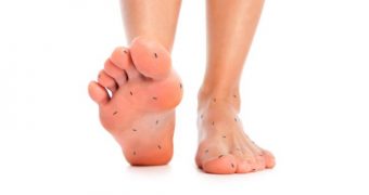 Amorțeala picioarelor – cauze și remedii pentru picioare amorțite