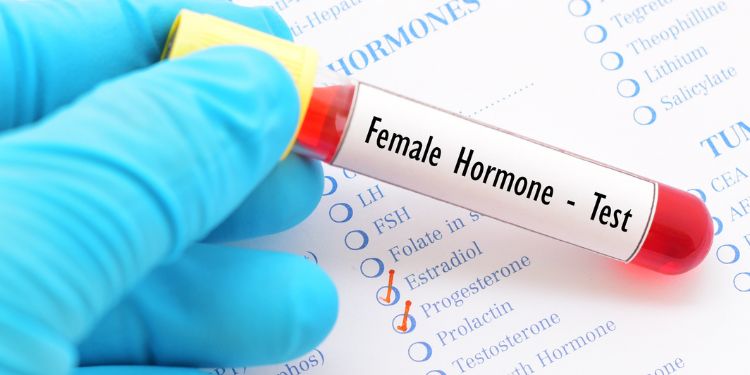 TSH, hormonul, hormoni, teste hormonale pentru femei,