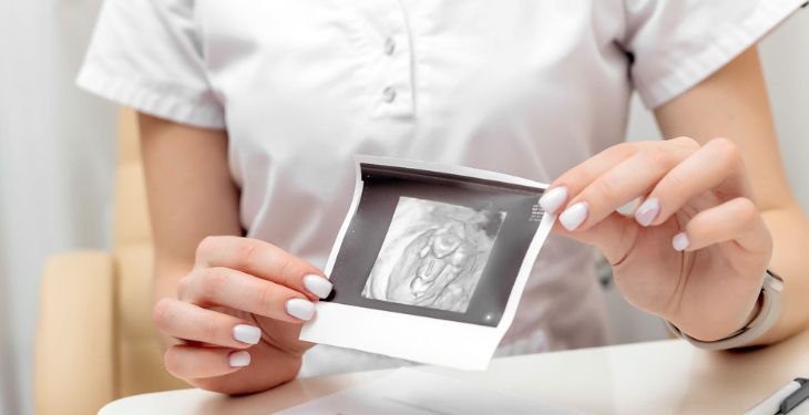 Chist ovarian – cauze și tratament