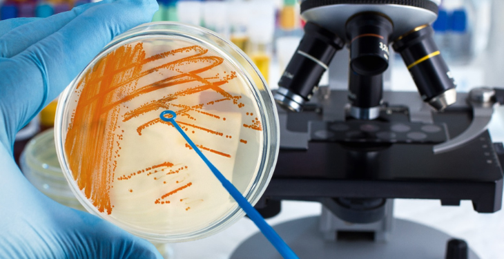 streptococ beta hemolitic grup B, infectie, cauze streptococ beta hemolitic, diagnostic streptococ beta hemolitic, tratament streptococ beta hemolitic, 