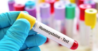 Homocisteina, indicator precoce în detectarea riscului de boli cronice