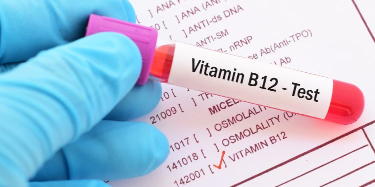 vitamina B12, B12, cobalamina, vitamină B12, cobalamină, 