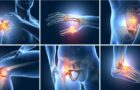 6 moduri în care vă puteţi păstra articulaţiile sănătoase