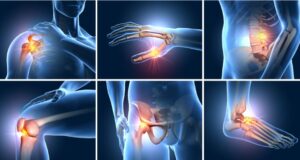 6 moduri în care vă puteţi păstra articulaţiile sănătoase