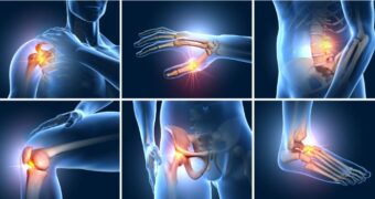 6 moduri în care vă puteţi păstra articulaţiile sănătoase