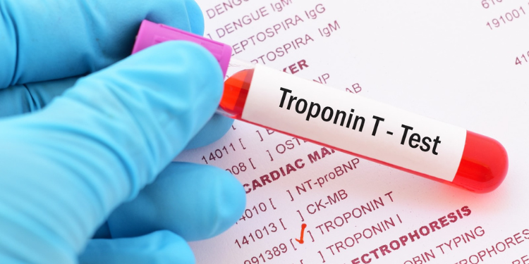 Ce este troponina și ce rol are această în diagnosticarea bolilor cardiace