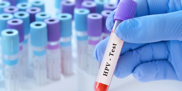 Testarea HPV și rolul său în depistarea precoce a infecției și a cancerului