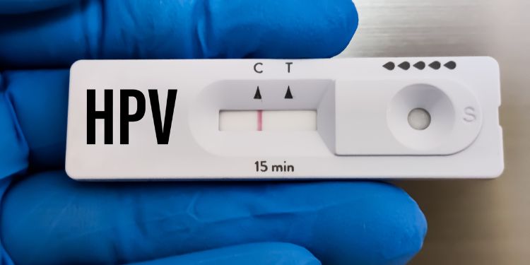 testare HPV, testare, HPV, Babeș-Papanicolau, Papanicolau, col uterin, cancer, cancerul de col uterin, 