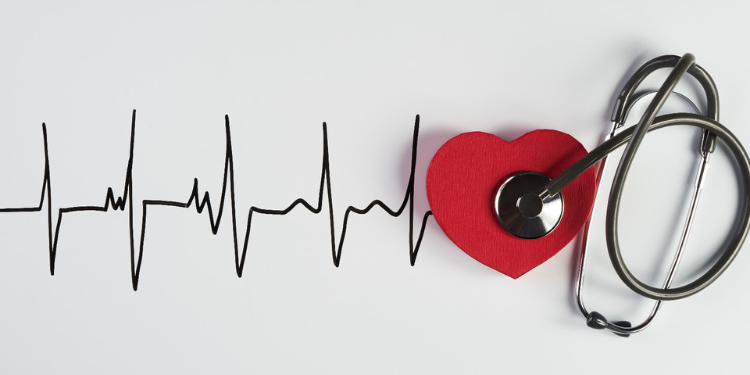 Aritmie cardiacă – manifestări clinice, diagnostic și tratament
