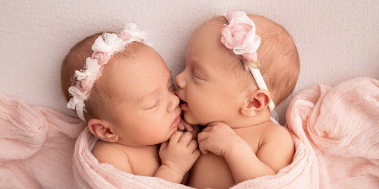 plagiocefalia, forma capului la bebelus, forma normala cap bebelusi, forma anormala cap bebelusi, forma capului la bebelusi,
