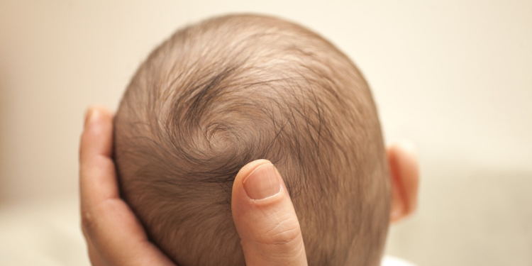plagiocefalia, forma capului la bebelus, forma normala cap bebelusi, forma anormala cap bebelusi, forma capului la bebelusi,

