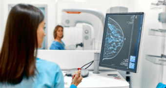 Studiu: mamografia nu doare