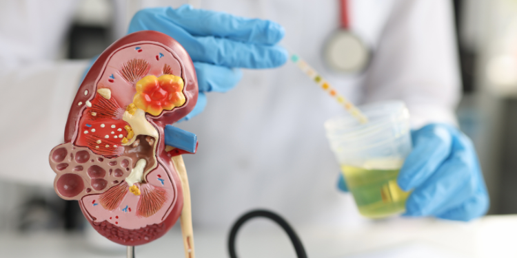 Mucus în urină – cauze, afecțiuni asociate și opțiuni de tratament