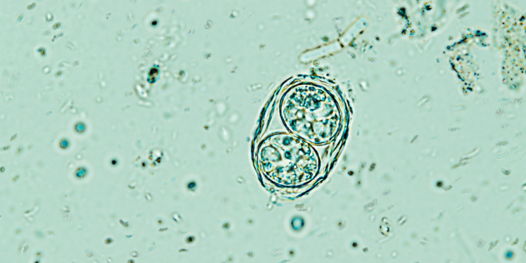 schizofrenie, pisici, toxoplasma gondii, tulburari mintale, riscuri, 