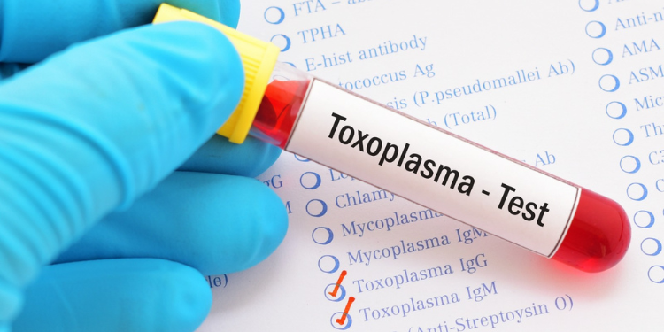 schizofrenie, pisici, toxoplasma gondii, tulburari mintale, riscuri, 