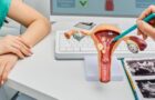 Polipii endometriali. Cauzele și manifestări clinice
