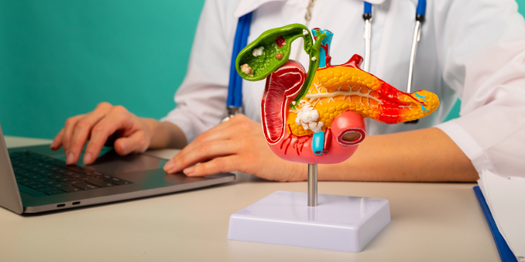 cancer de pancreas, simptome, tratament, factori de risc, cauze, manifestari, remedii, 