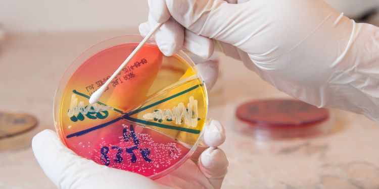 Staphylococcus aureus