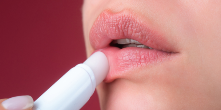 herpes bucal, simptome herpes, cum arata herpes, cauze herpes, tratament herpes,