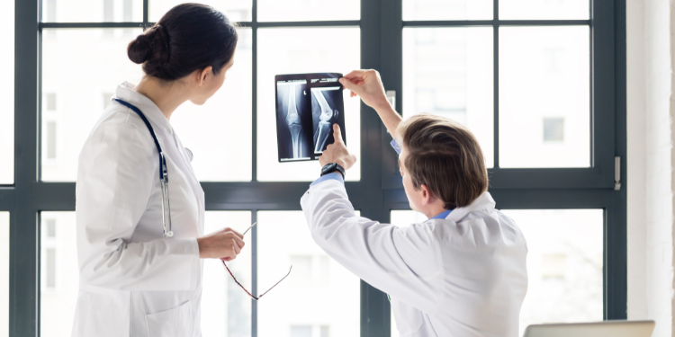 ce este fractura cominutiva, simptome fractura cominutiva, cauze fractura cominutiva, tratament fractura cominutiva, diagnostic fractura cominutiva, 