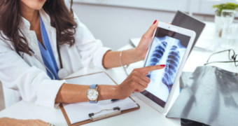 Micronoduli pulmonari: cauze, factori de risc, simptome, diagnostic și abordări terapeutice