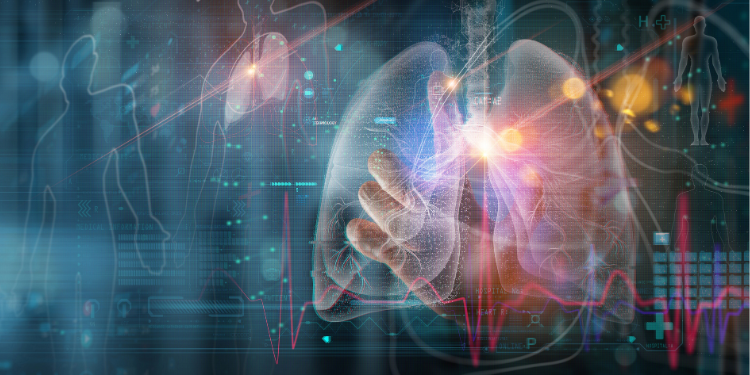 micronoduli pulmonari, cauze micronoduli pulmonari, tratament micronoduli pulmonari, diagnostic micronoduli pulmonari, simptome micronoduli pulmonari, 