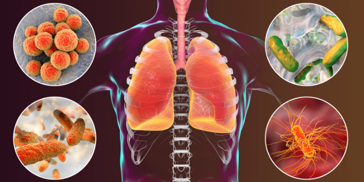 pseudomonas aeruginosa, bacterie, infectii nosocomiale, infectii pulmonare, simptome, tratament, 