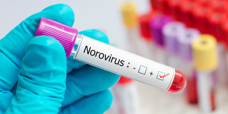 infectia cu norovirus, gastroenterita, virus norwalk, infectia cu virus Norwalk, simptome norovirus, preventie norovirus, remedii notovirus, 