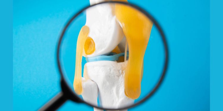 gheara diavolului beneficii, gheara diavolului proprietati, gheara diavolului proprietati antiinflamatorii, gheara diavolului utilizari, gheara diavolului efecte secundare,