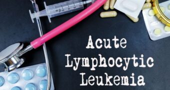 Leucemie limfoblastică acută. Simptome, diagnostic, tratament