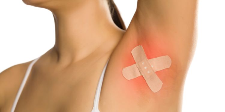 ce este foliculita, cum se manifesta foliculita, foliculita cauze, foliculita simptome, foliculita diagnostic, foliculita preventie,