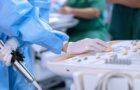 Ecocardiografie transesofagiană. Ce este, cum se efectuează și când este necesară