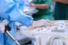 Ecocardiografie transesofagiană. Ce este, cum se efectuează și când este necesară