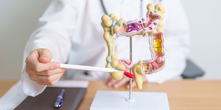 sangerari rectale tratament, sangerari rectale preventie, sangerari rectale cauze, sangerari rectale boli, sangerari rectale hemoroizi, sangerari rectale fisuri anale,