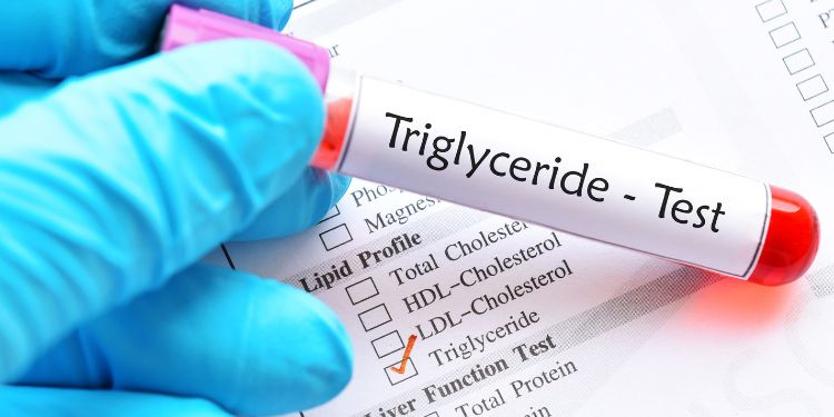 trigliceride valori normale, trigliceride crescute, trigliceride crescute cauze, trigliceride crescute riscuri, trigliceride crescute simptome,
