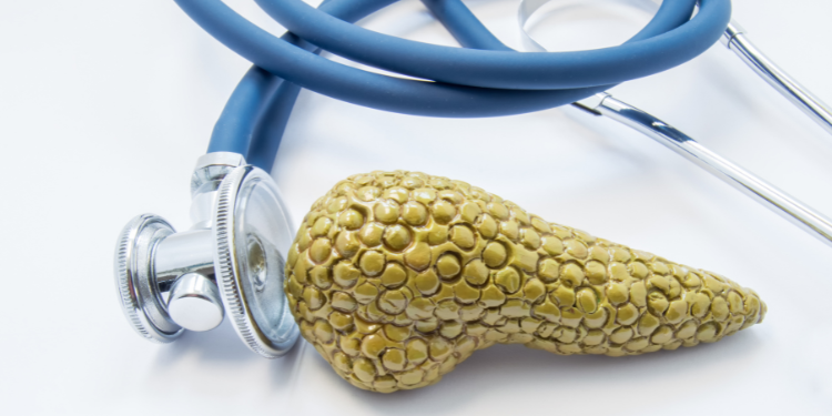 adenocarcinom, cancer, diagnostic adenocarcinom, tratament adenocarcinom, 