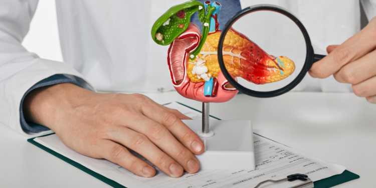 neoplasm pancreatic, cancer de pancreas, simptome neoplasm pancreatic, diagnostic neoplasm pancreatic, tratament neoplasm pancreatic, 