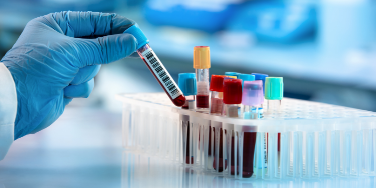 boala inflamatorie intestinala, boala crohn, colita ulcerativa, simptome boala crohn, tratament boala crohn, simptome colita ulcerativa, tratament colita ulcerativa, 