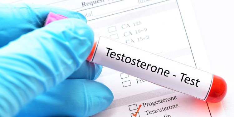 cauze testosteron scazut la barbati, testosteron scazut la barbati diagnostic,