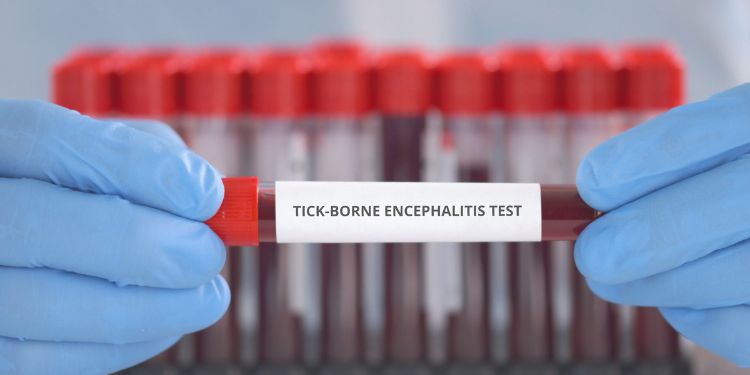 diagnostic encefalita de capusa, diagnostic, teste de sange encefalita de capusa