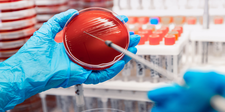 sepsis, sindrom de disfunctie de organ, infectie, riscuri sepsis, tratament sepsis, preventie sepsis,