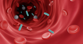 Sepsis: ce este și de ce reprezintă o urgență medicală?