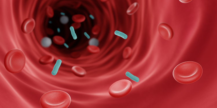 Sepsis: ce este și de ce reprezintă o urgență medicală?