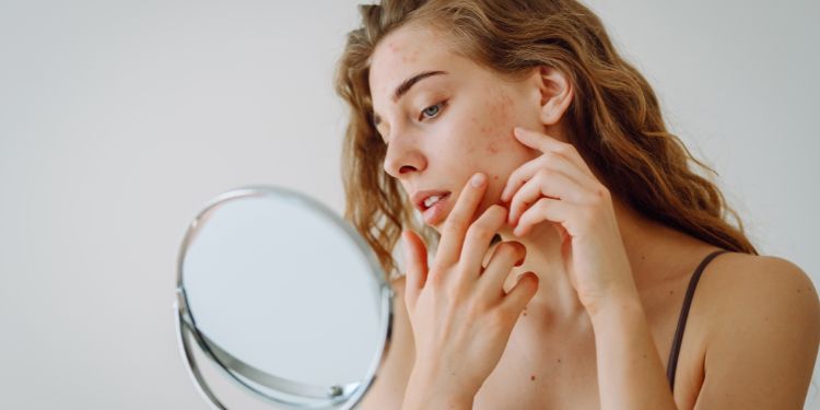 boli dermatologice cauzate de stres,